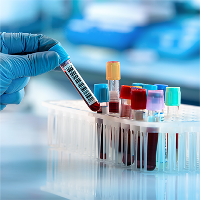 infection_control_measures_ifb_commercial_solutions.png